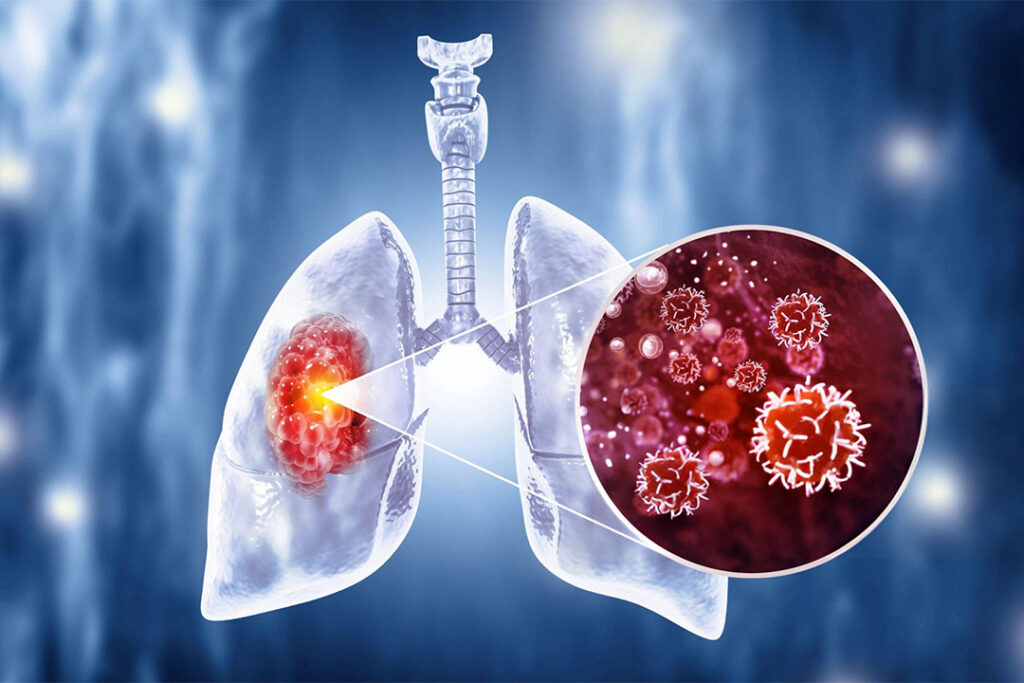 best oncologist in Vaishali