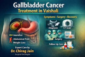 Gallbladder Cancer Treatment in Vaishali